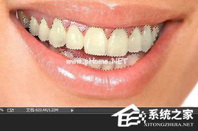 PS牙齿怎么变白？PS牙齿变白的方法