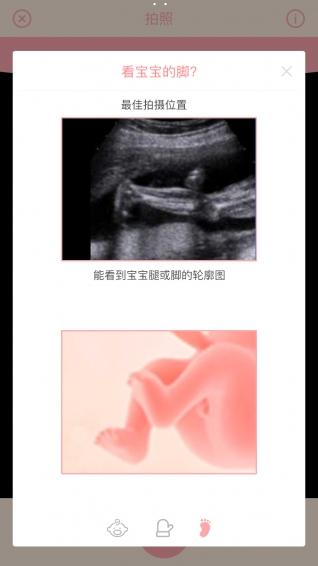 胎儿相机app下载